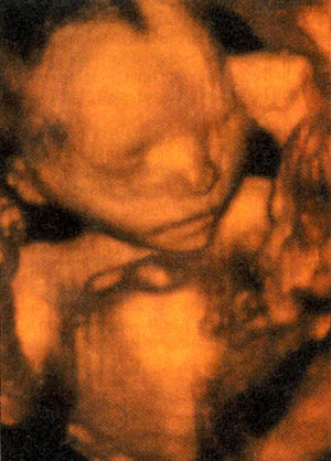 A picture of a baby from a pregnancy scan