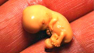 A tiny aborted baby